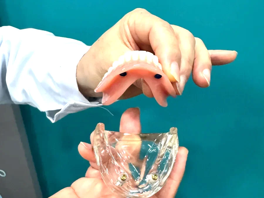 원장님 손에 든 틀니 안쪽 연결 부분과 모형 받침
